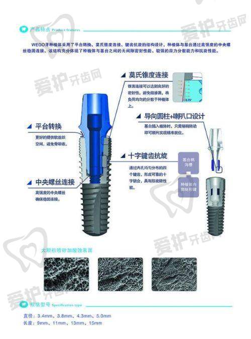 选择上海瑞伢美口腔冯春做高难度穿颧穿翼全口种植有哪些优势?