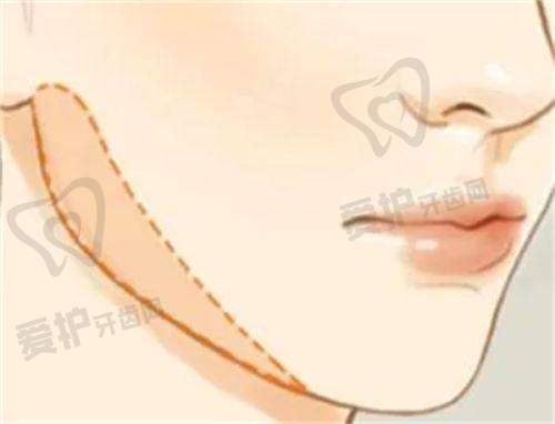 上海华美医疗美容医院如何打造专属美丽传奇?