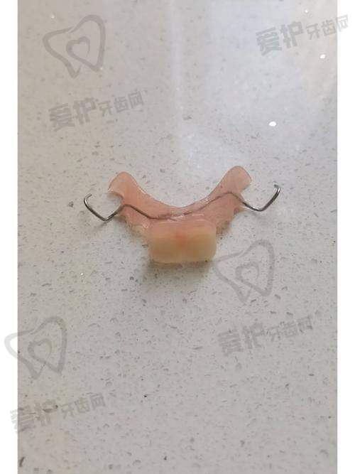 上海瑞伢美口腔开展活动义齿项目，仅11000元起，品质优良超划算 