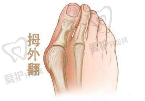 注射塑妍萃固定轮廓的价格分阶情况