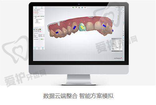 在西安中诺口腔做韩国美格真种植牙的流程是怎样的？