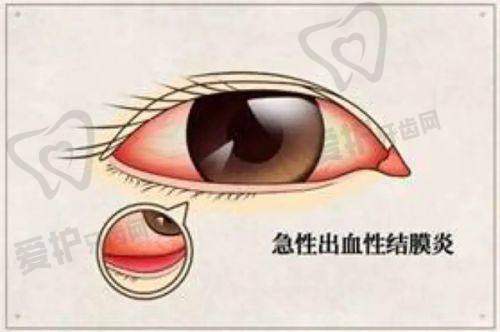 重庆爱成眼科医院飞秒精细化雕刻手术的价格分阶情况是怎样的?