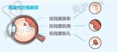重庆爱成眼科医院的服务保护如何?