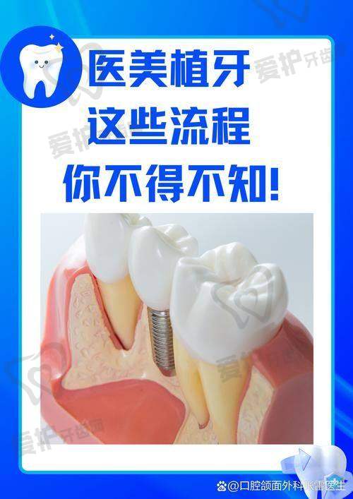 韩国奥齿泰种植牙是什么？