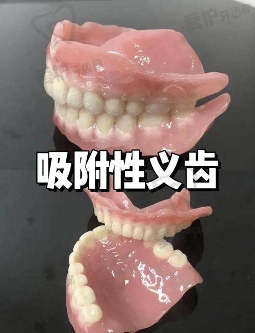 福州维乐口腔开展BPS吸附性义齿项目11800元起，品质优体验好！ 
