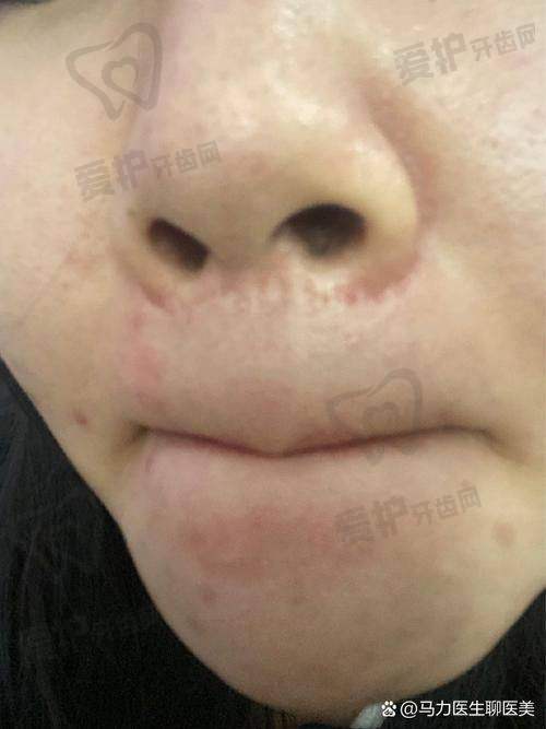 为什么选择深圳福雅范开防医生？