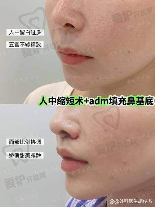 总结