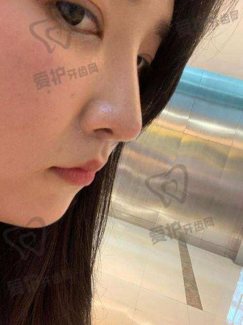 术前准备工作有哪些？