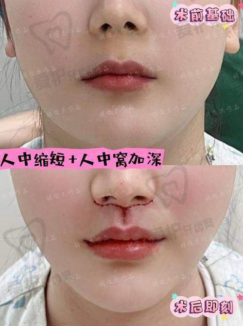 患者的真实实例分享