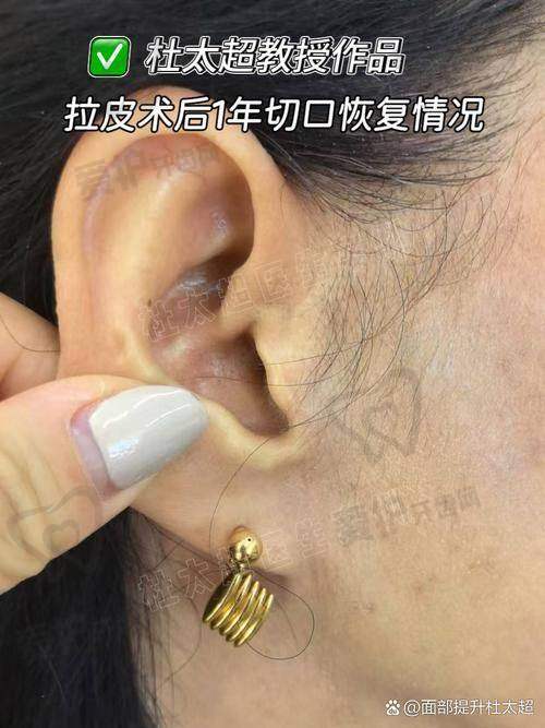 选择专精医生，降低手术风险