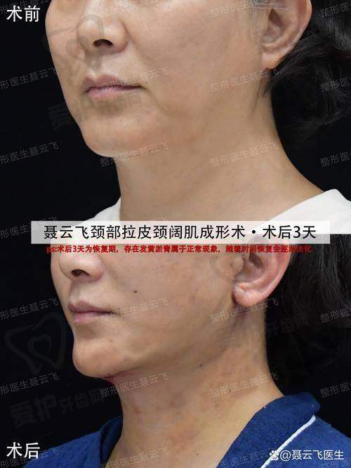 结语