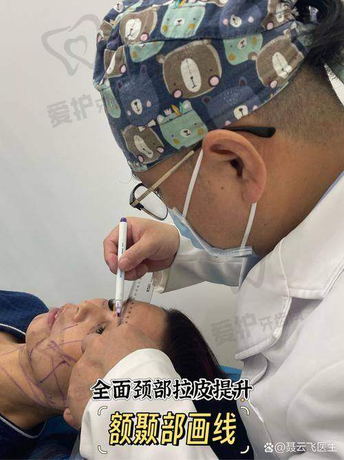 如何提高拉皮手术成效的维持时间
