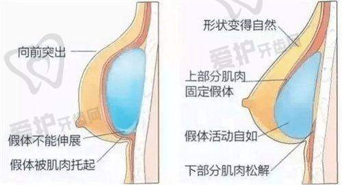 超皮秒焕肤的治疗过程