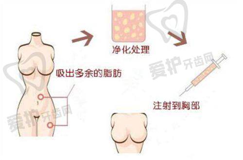 郑州壹加壹超皮秒680元起:性价比之选