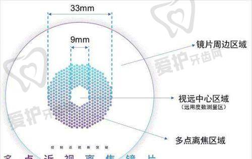嘉兴爱尔眼科精细化雕刻飞秒手术的流程是怎样的?