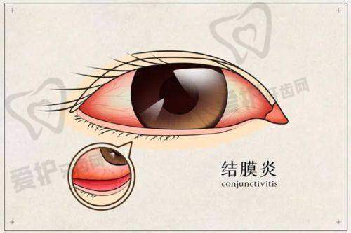 哪些眼科项目可以使用医疗保险