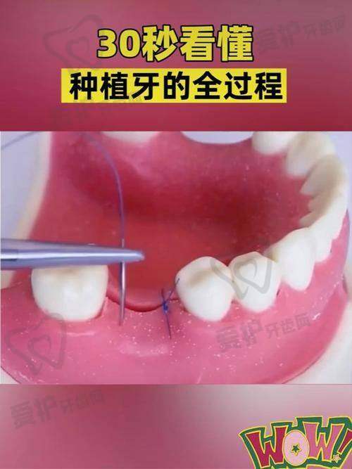 患者真实评价见证上海薇琳口腔的实力