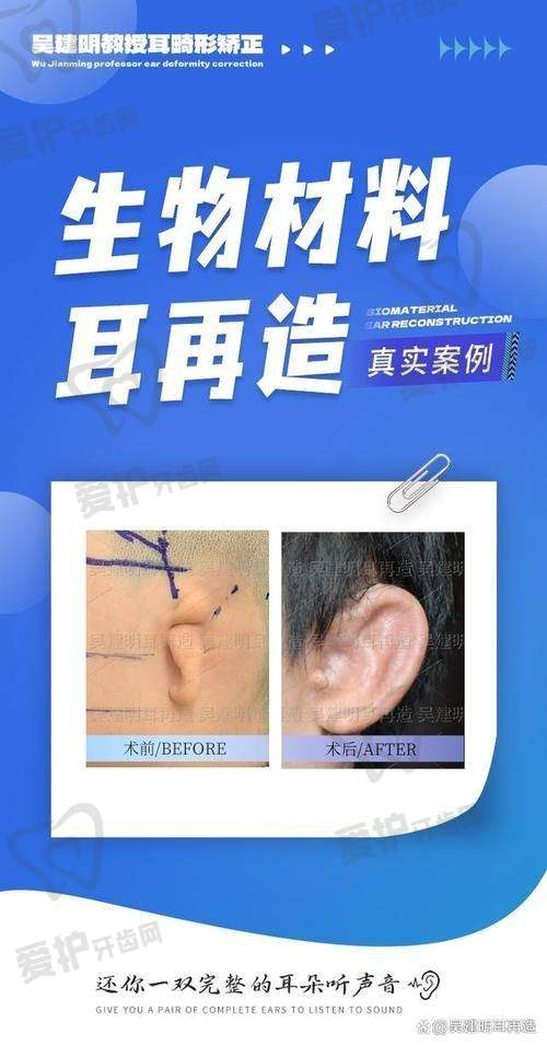 与其他耳再造整形机构相比，成都八大处章庆国医生的优势在哪里？