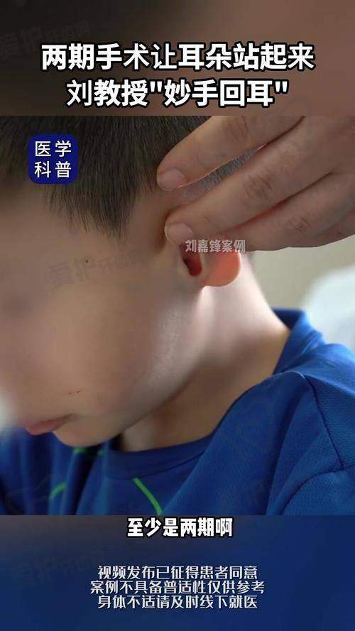 耳再造整形手术有哪些优势？