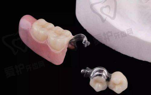 福州维乐口腔医院全口假牙的制作流程是怎样的？