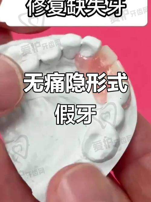 全口假牙的材质有哪些？价格如何？