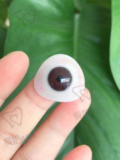 义眼片是什么？它的作用和原理