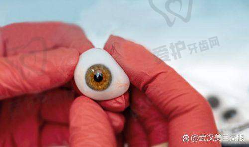 佩戴义眼片可能会出现哪些问题？如何解决