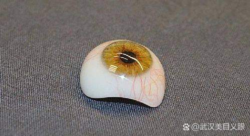 义眼片需要每天都摘下来吗？影响因素有哪些