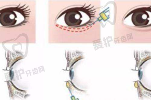 北京嘉禾医疗美容的服务质量如何?