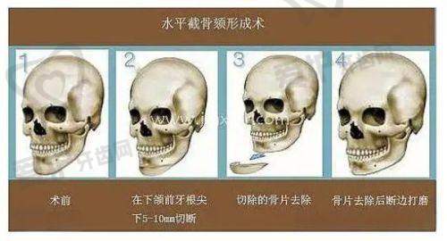总结