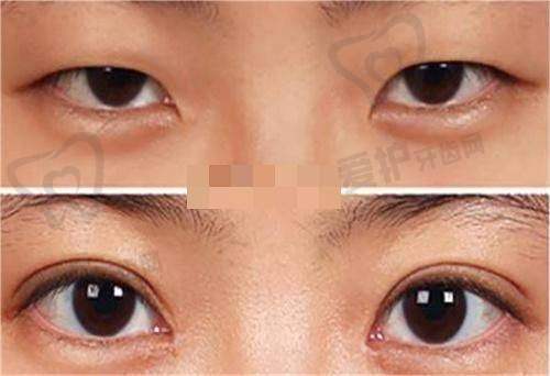 北京嘉禾医疗美容的医生实力怎么样?