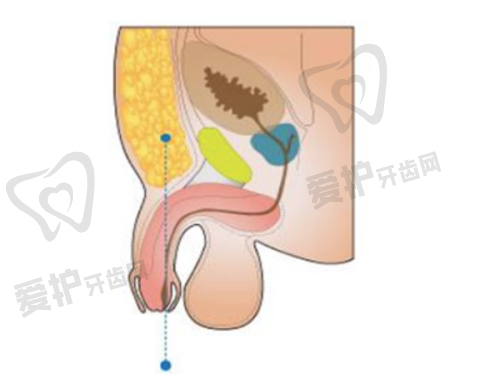 上海侣同帅眼的术后修复快吗?