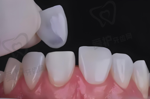 王梧君医生:正畸与修复的双料能手