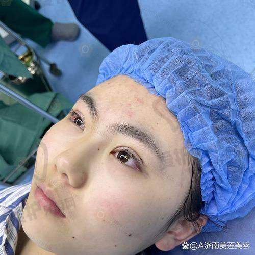 眼综合手术包括什么项目？