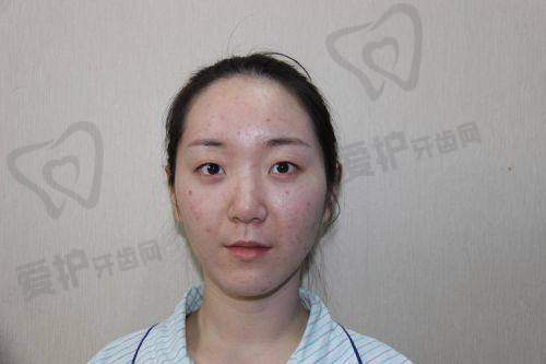 张嘉林医生在双眼皮整形领域有何独特之处？