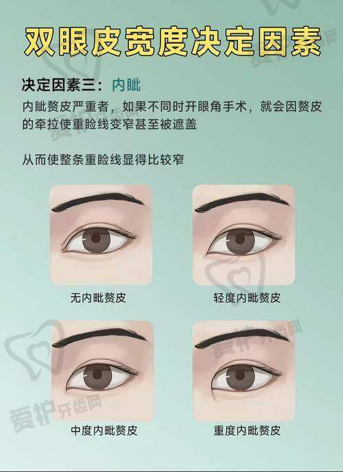 如何预约佀同帅医生的双眼皮修复手术？