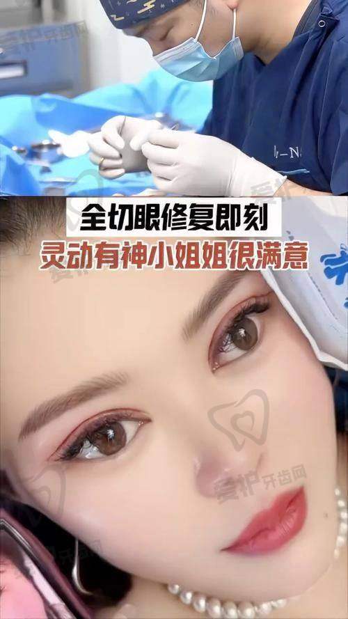 双眼皮修复后能达到怎样的成效？