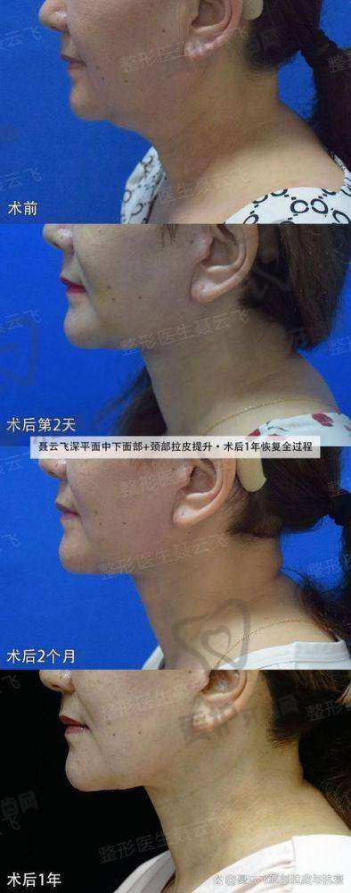 结语
