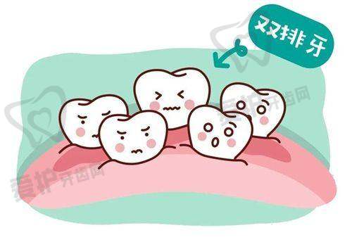五、慈溪博瓦口腔门诊收费价格: