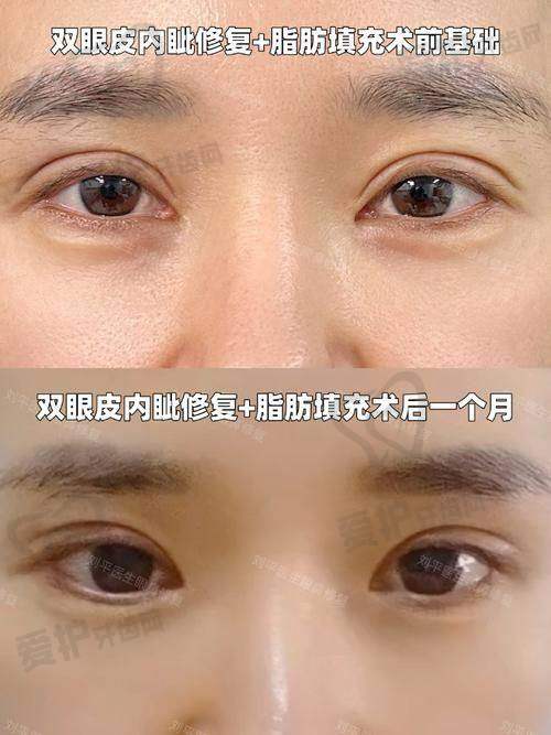总结