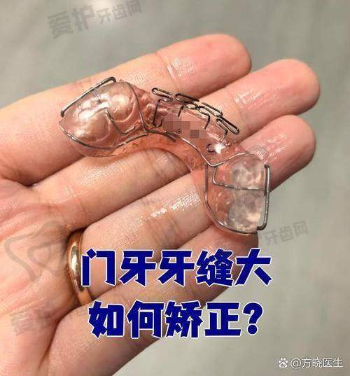 6、慈溪博瓦口腔何畔医生预约挂号指南