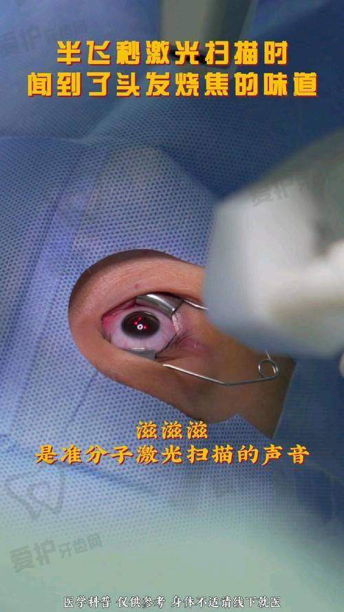 半飞秒近视手术的价格为何是12800元起？
