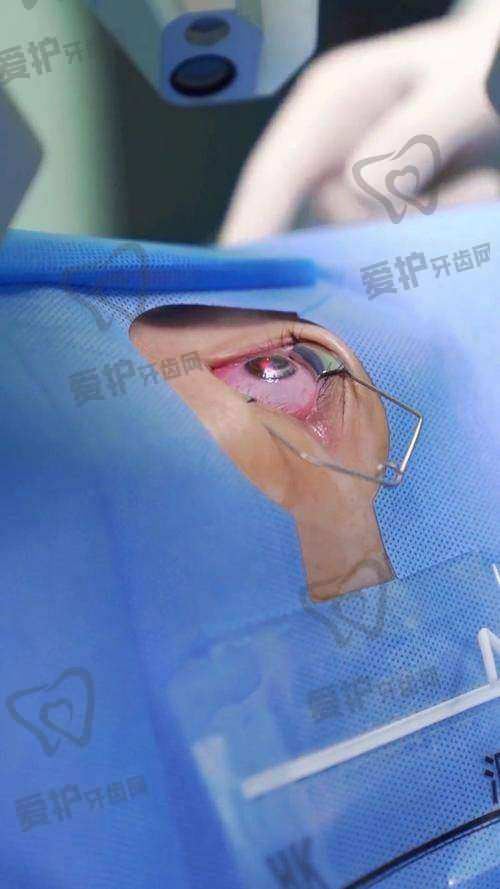 石家庄复明眼科陈费清院长主刀半飞秒近视手术12800元起，性价比超高！ 