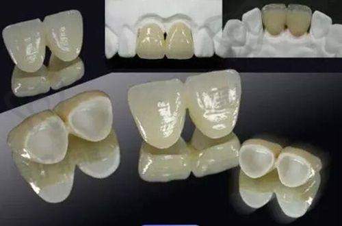 患者对重庆团圆口腔医院的评价