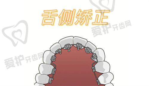 2、吉安皓靓口腔徐晴玲医生牙齿矫正怎么样？