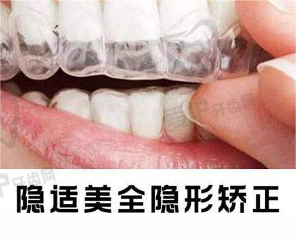 1、吉安皓靓口腔徐晴玲医生怎么样？