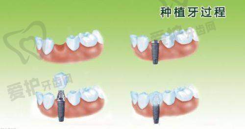 重庆团圆口腔医院简介