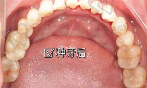 6、三亚舒诺口腔张颖医生预约挂号指南