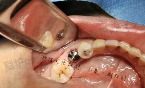3、三亚舒诺口腔张颖医生诊疗项目收费价格：