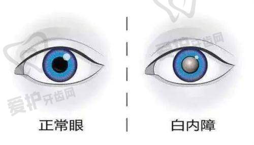 不做手术会有什么后果？